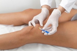 Types of Knee Injections