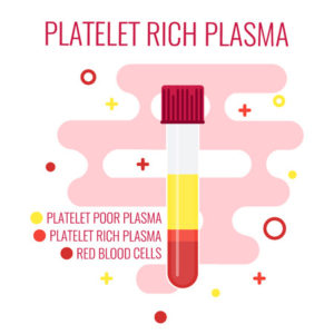 Platelet Rich Plasma in Denver